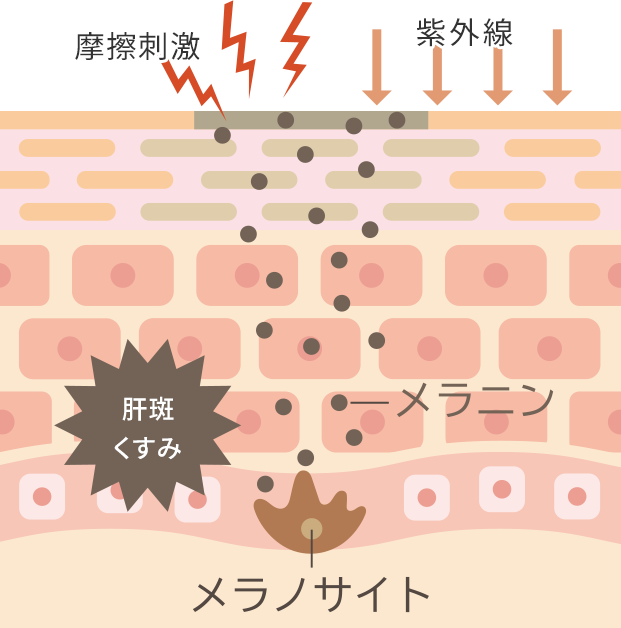 肝斑・くすみができる原因