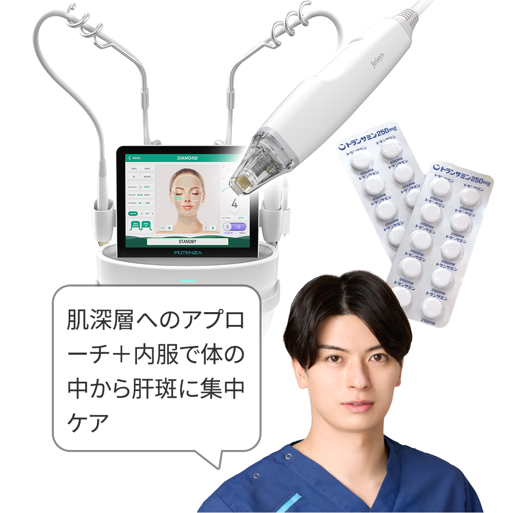 ポテンツァ(肝斑)+トラネキサム酸内服+トラネキサム酸クリーム