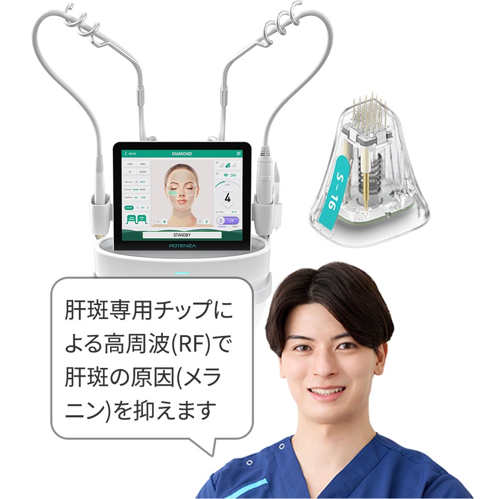 ポテンツァ(肝斑)