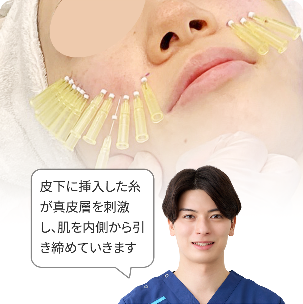 【たるみ毛穴】ショッピングリフト