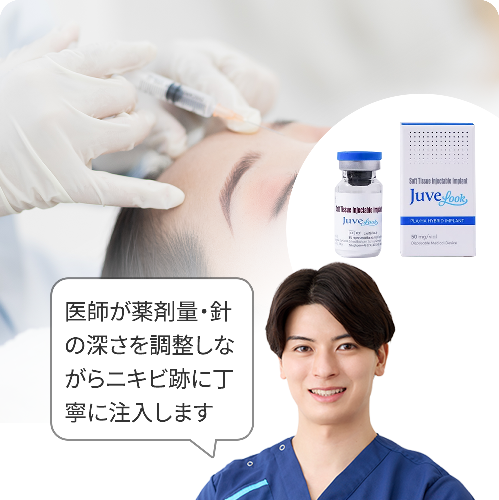 手打ち水光(ジュベルック)+トラネキサム酸