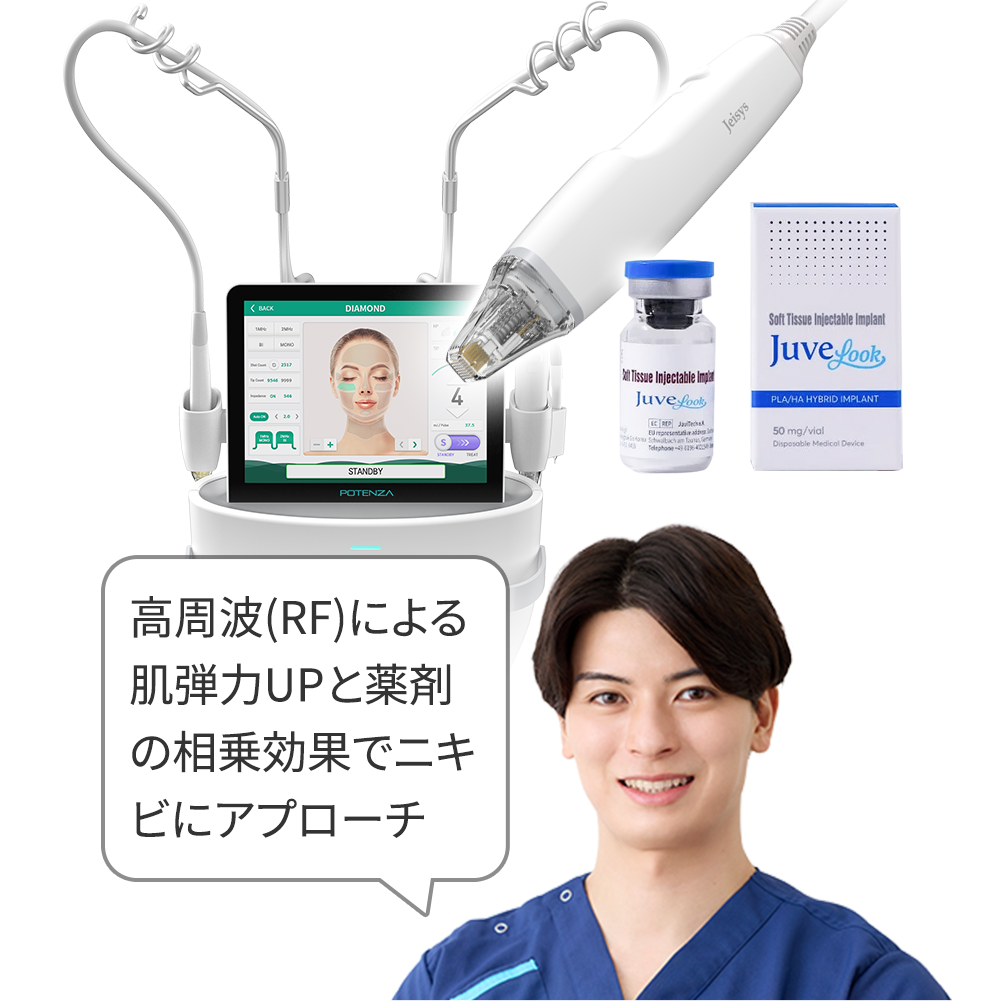 ポテンツァ(ジュベルック)