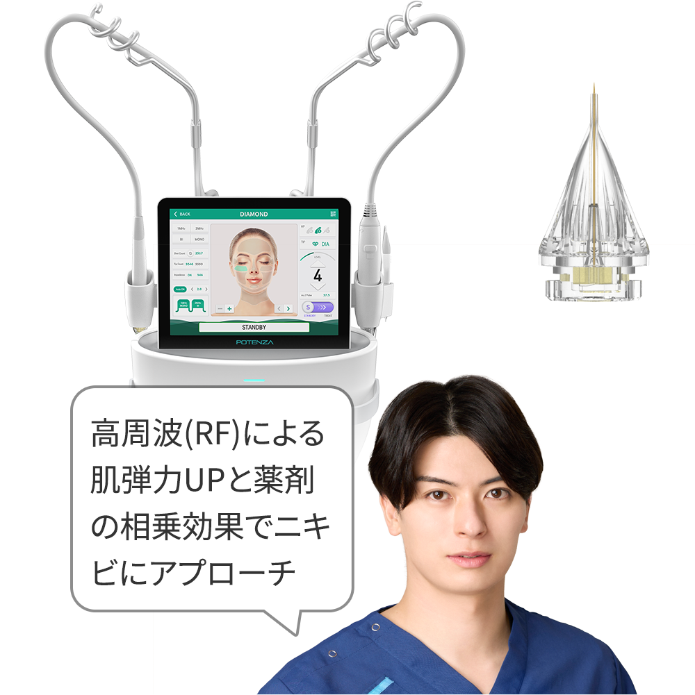 ポテンツァ