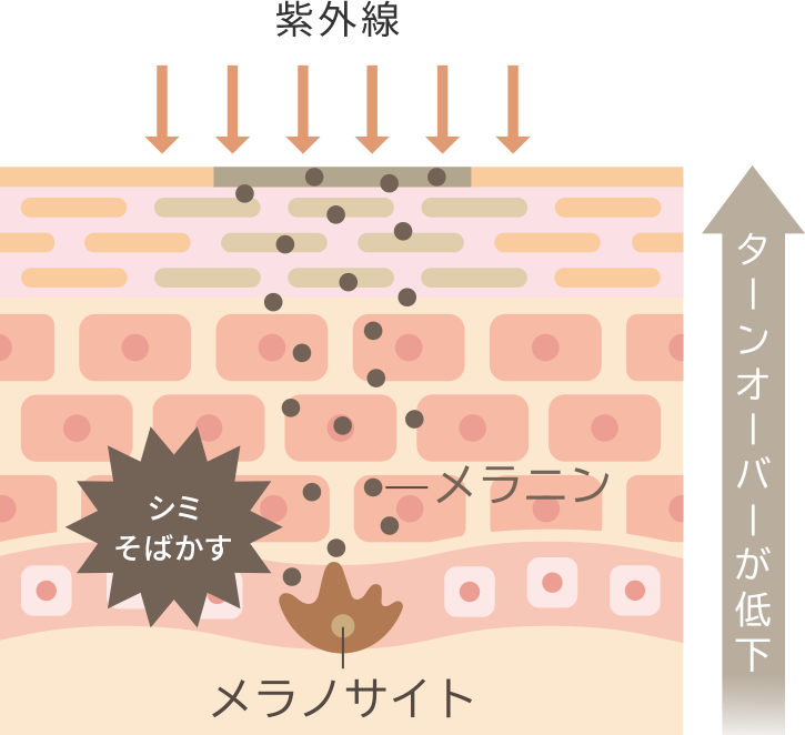 シミ・そばかすができる原因