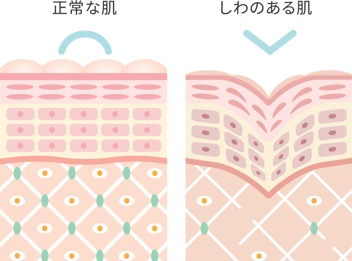 たるみ・シワが目立つ原因