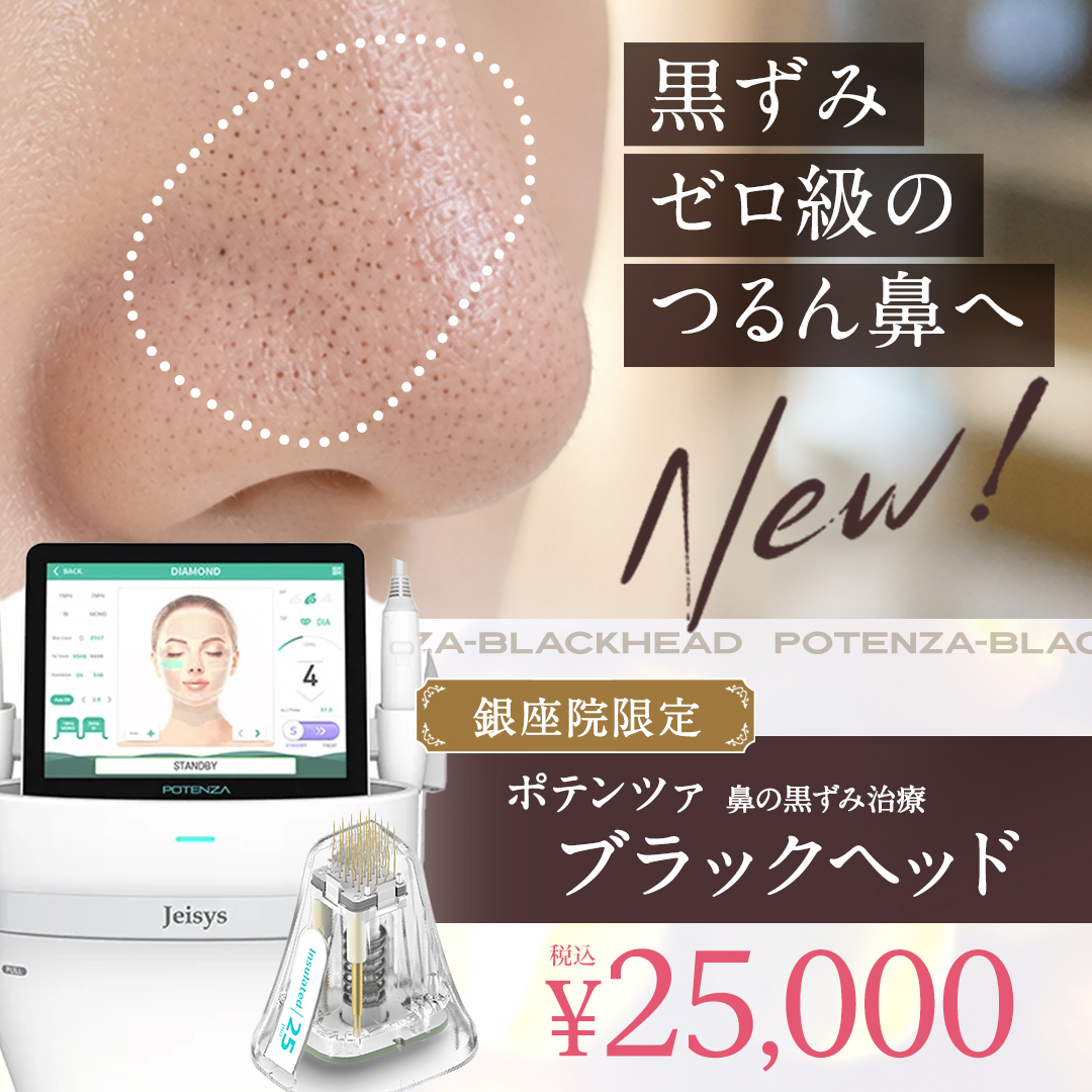 ポテンツァブラックヘッド