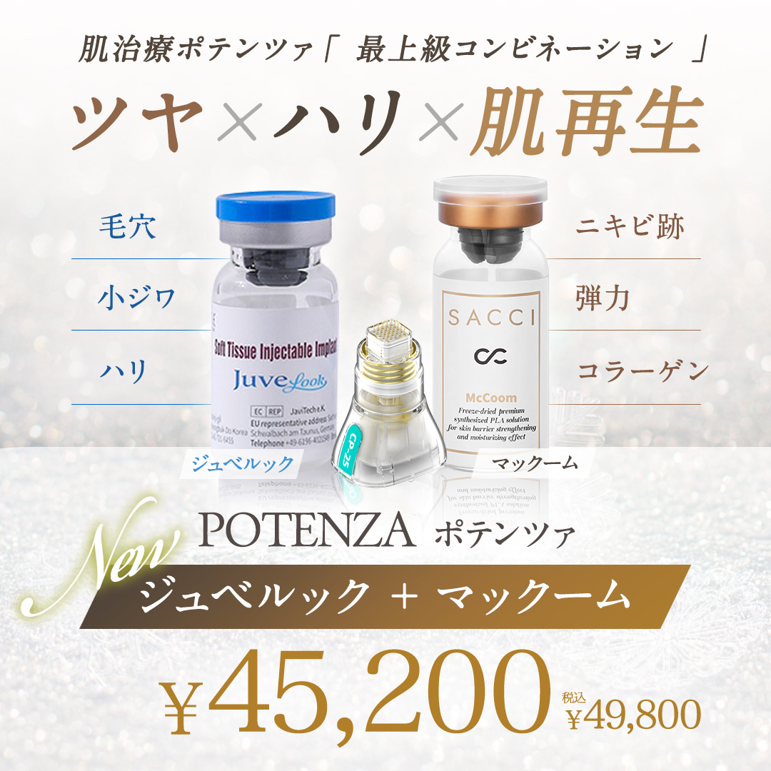 ポテンツァ ジュベルックキャンペーン