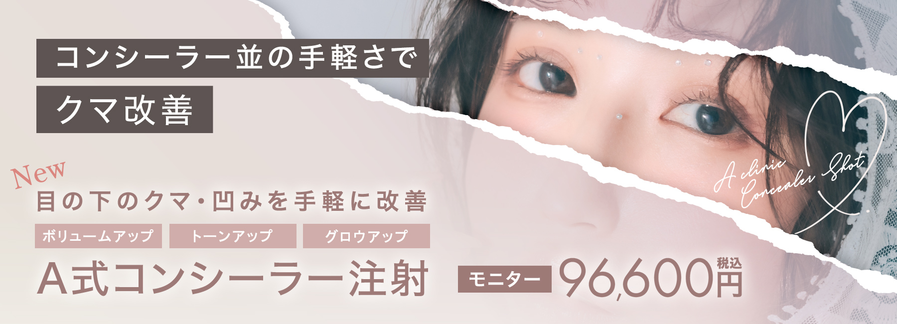 A式コンシーラー注射モニター