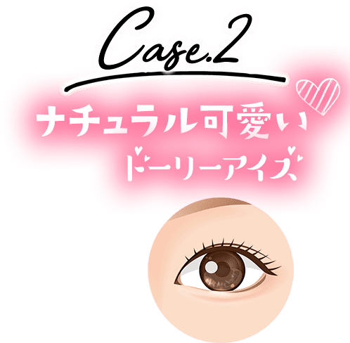二重 涙袋ドーリーアイズ 美容整形のa Clinic 美容外科 美容皮膚科 形成外科