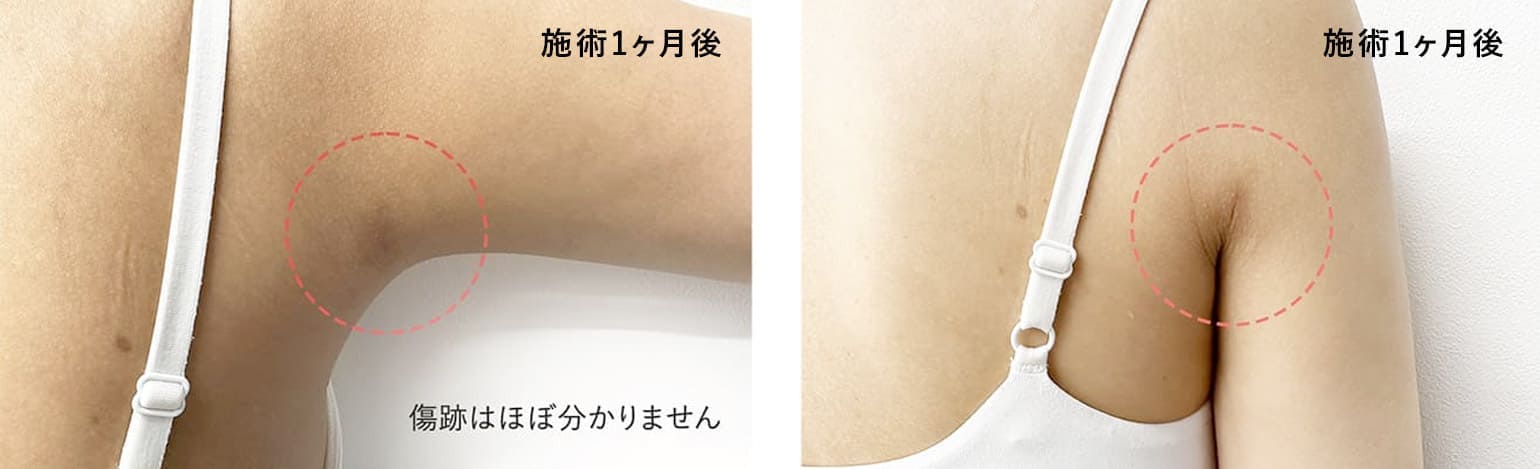 ダウンタイムの症例写真