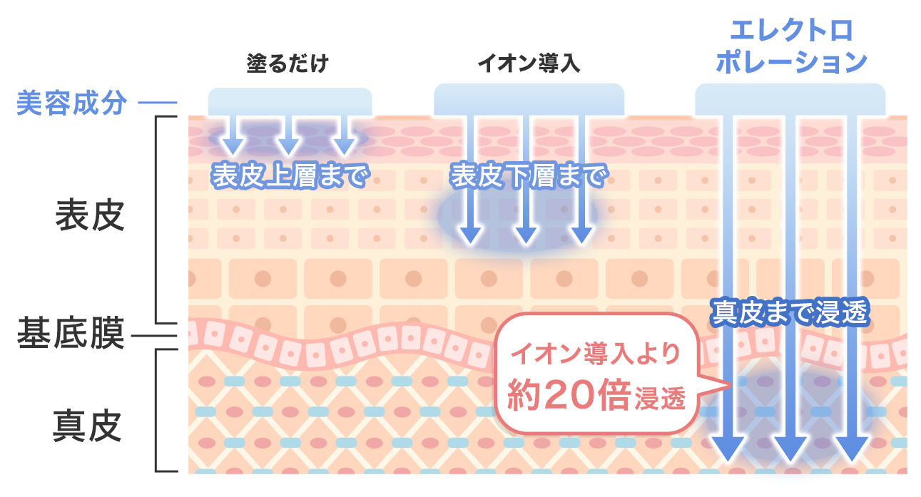 エレクトロポレーションとは