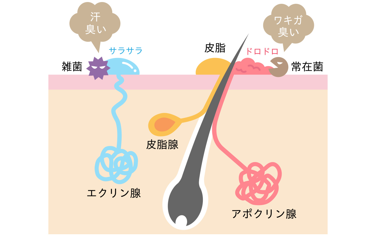 フェムボトックス(すそわきが)