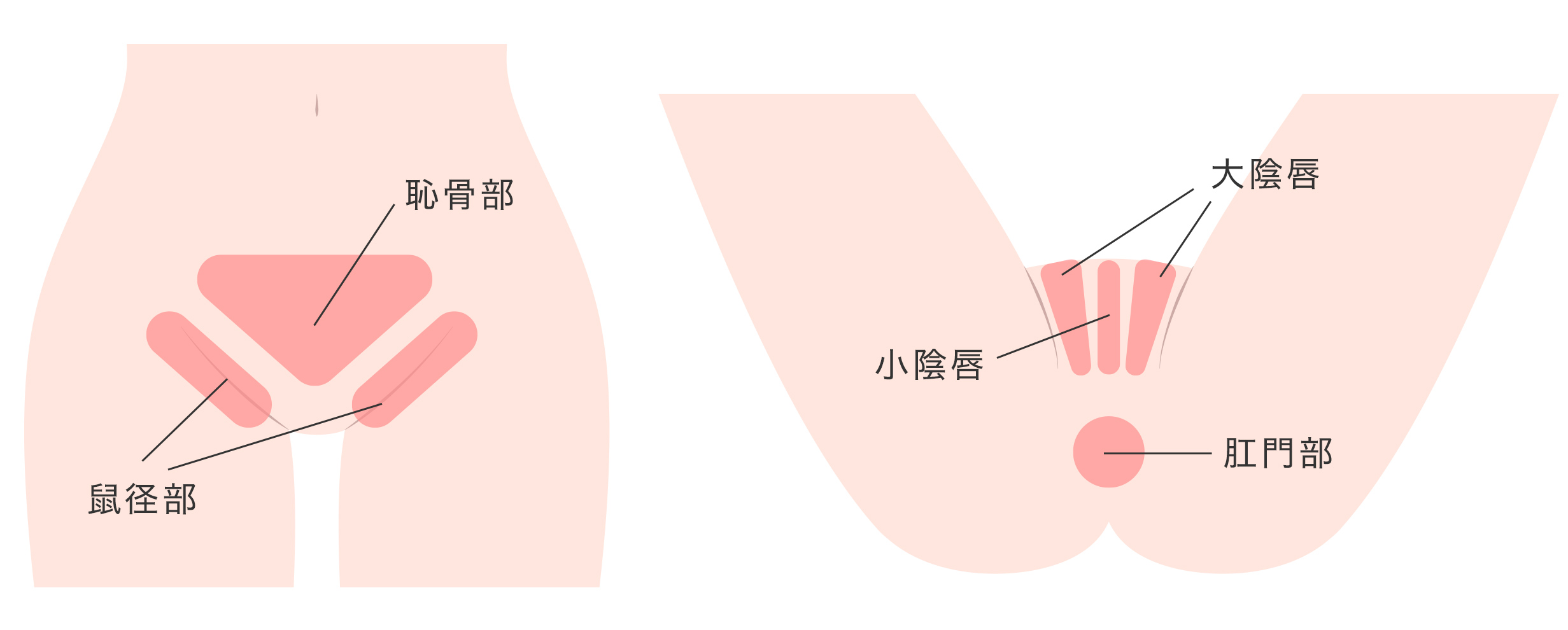 フェムレーザーの施術箇所