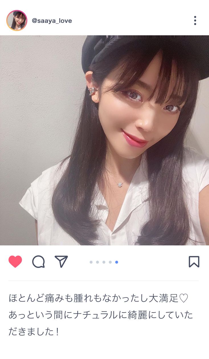ほとんど痛みも腫れもなかったし大満足♡あっという間にナチュラルに綺麗にしていただきました！ @saaya_love
