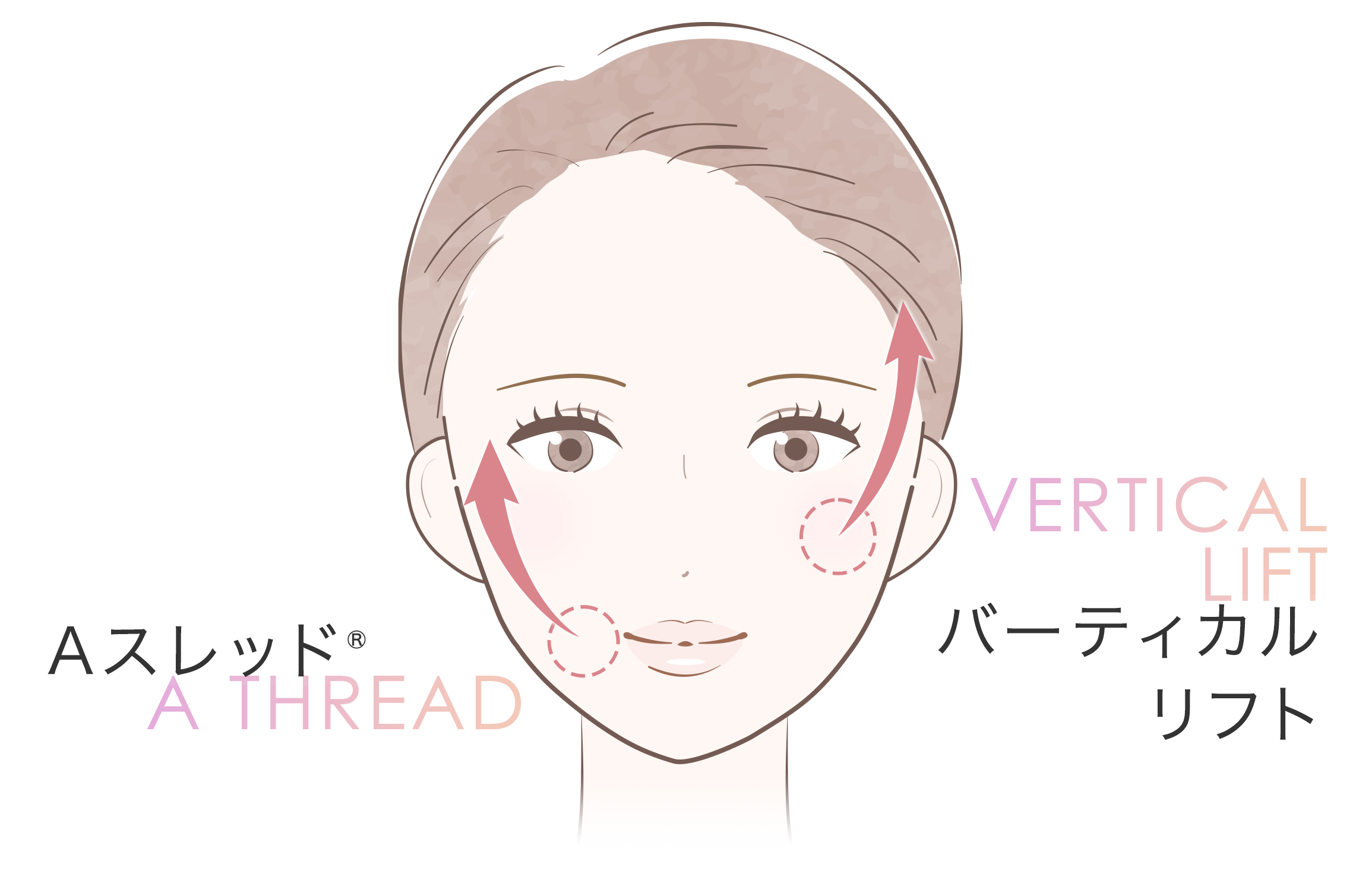 バーティカルリフトの効果
