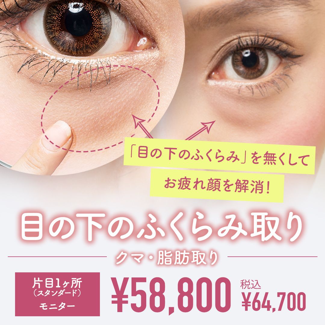 目の下のふくらみ取り
