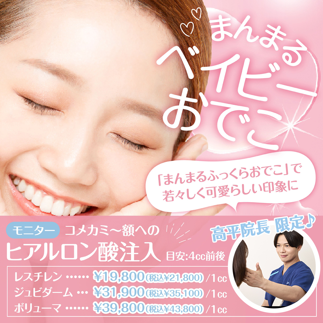 まんまるベイビーおでこ