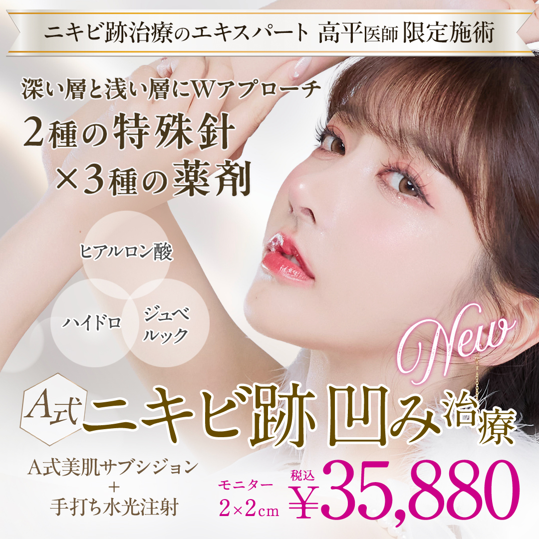 A式ニキビ跡凹み治療