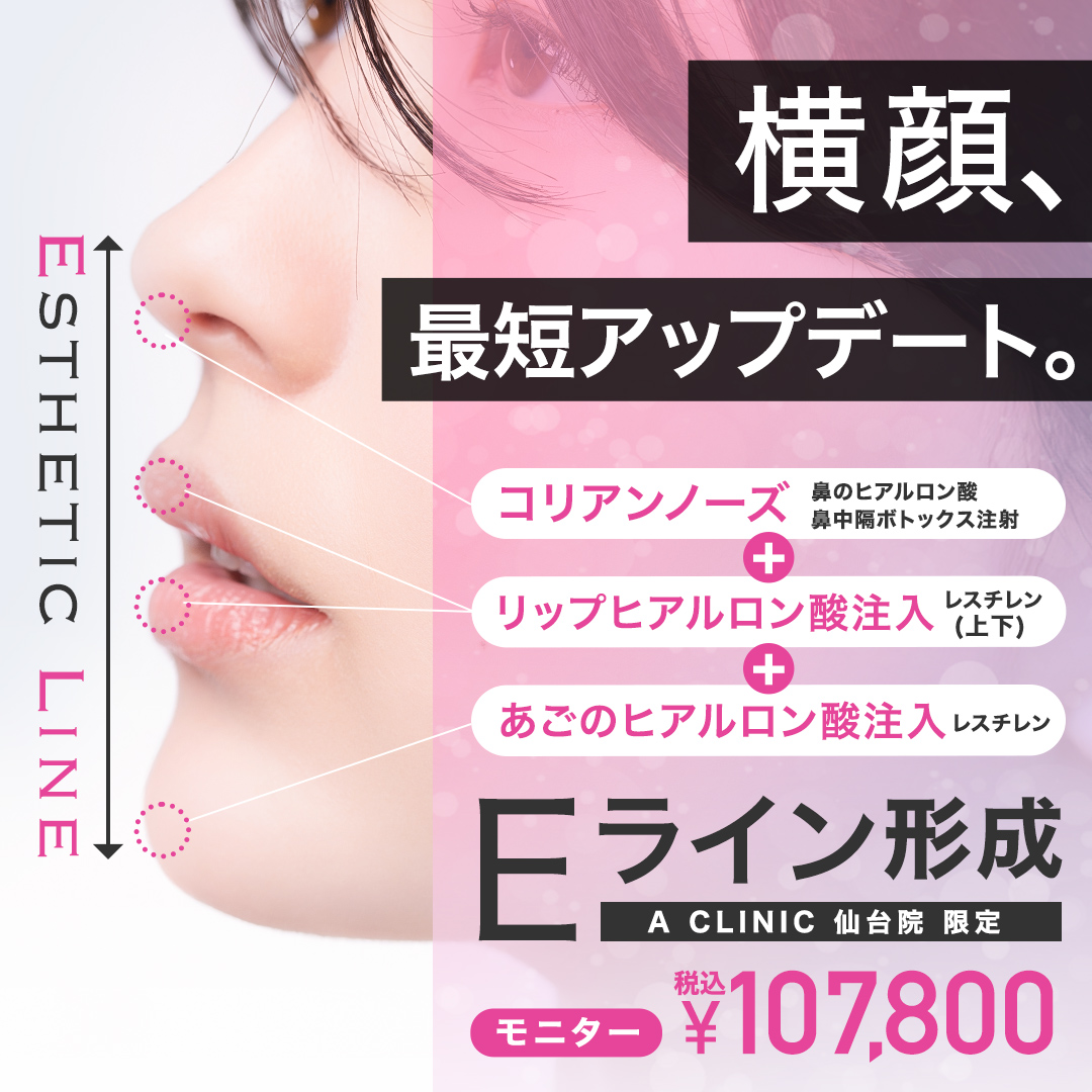 A式ナゾラリフト症例写真