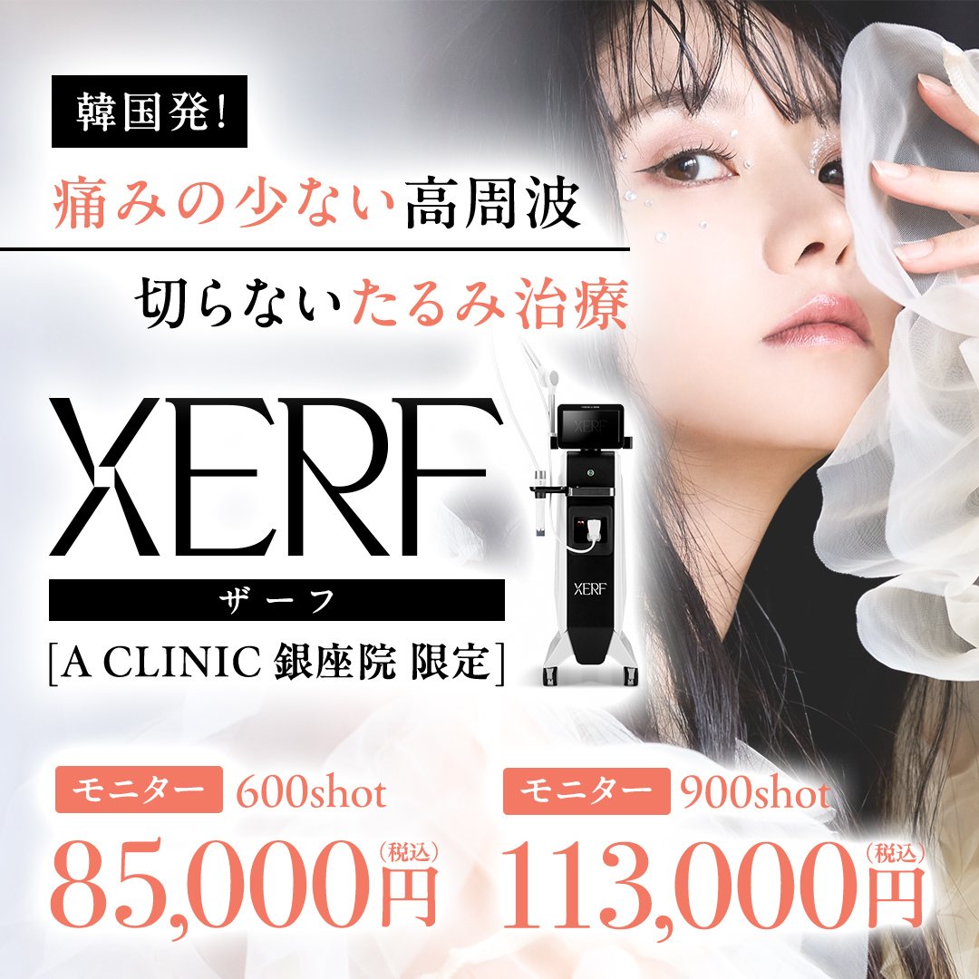 XERF(ザーフ)