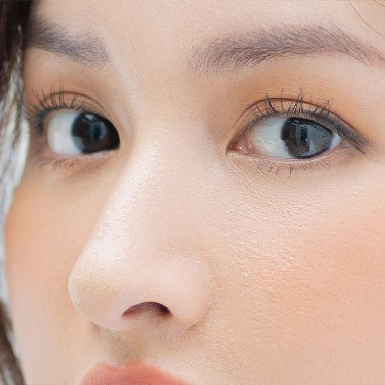 目尻切開法 たれ目 目元の美容整形ならa Clinic