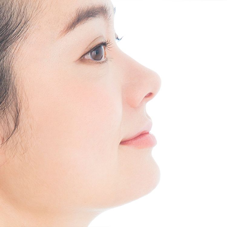 鼻プロテーゼ 隆鼻術 A Clinicは小顔 リフトアップ専門の美容整形クリニック