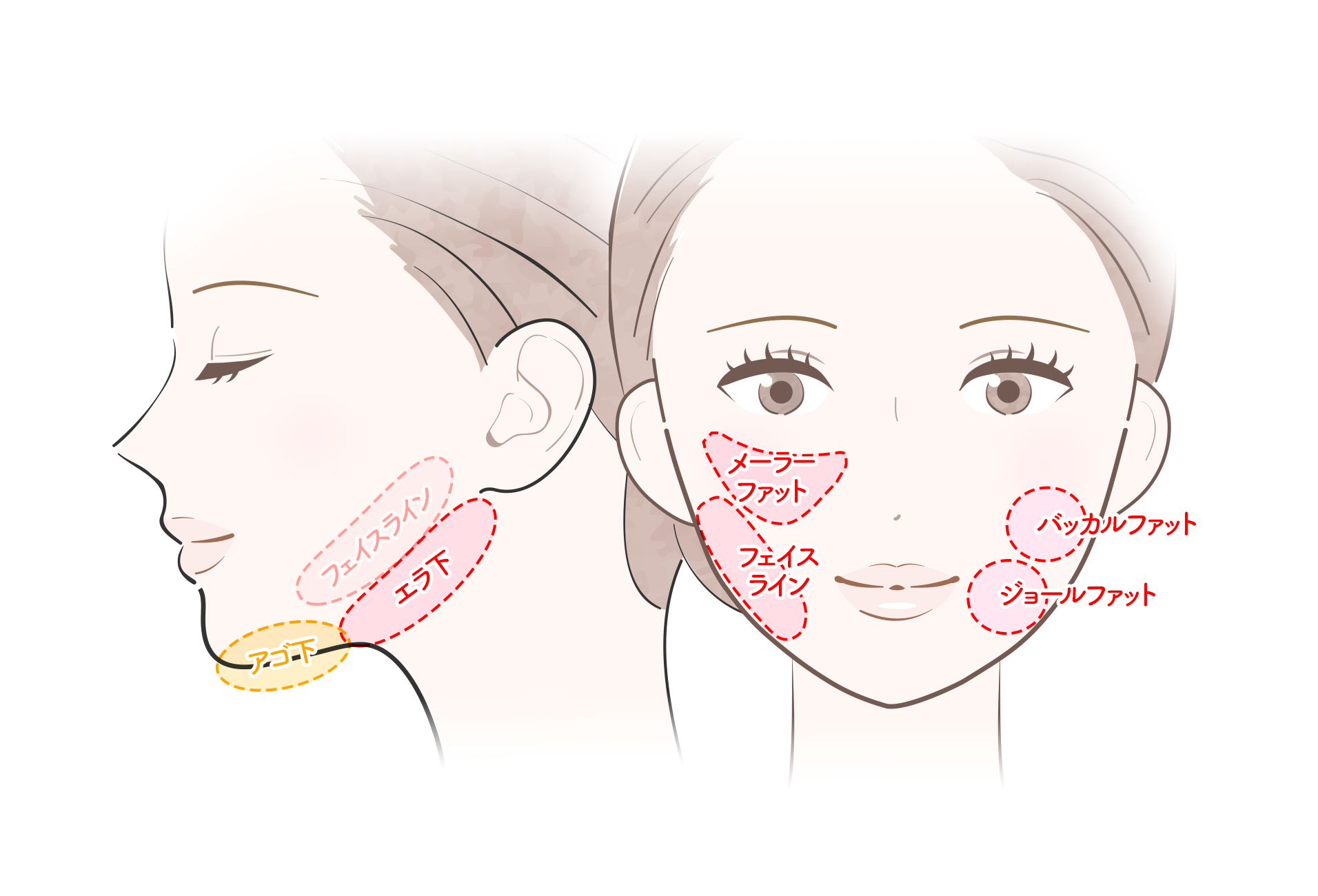脂肪吸引の施術部位(オプション)