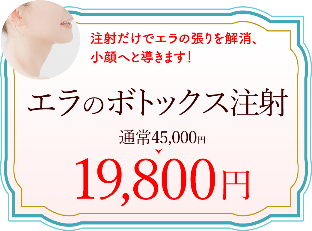 エラのボトックス注射