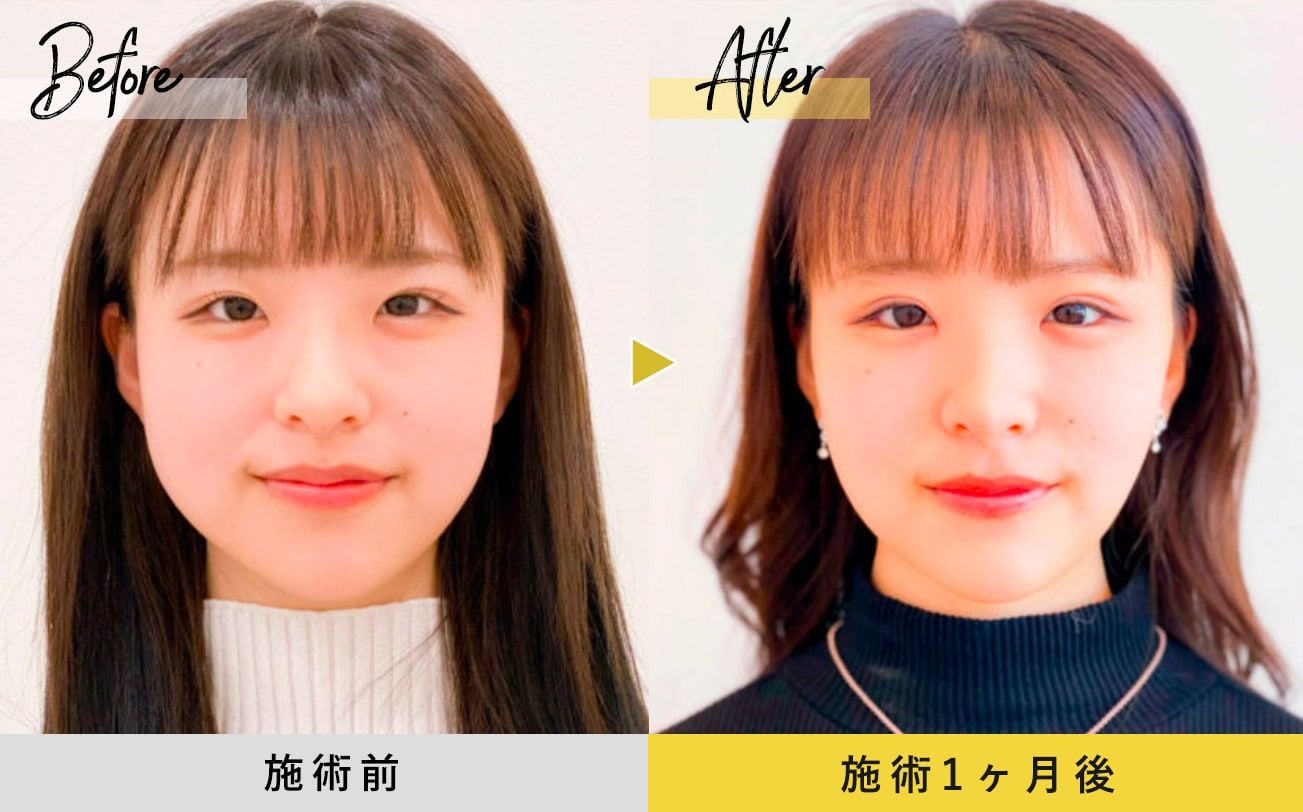 症例写真