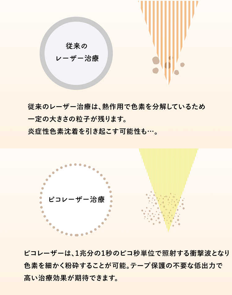 ピコスポット A Clinicは小顔 リフトアップ専門の美容整形クリニック