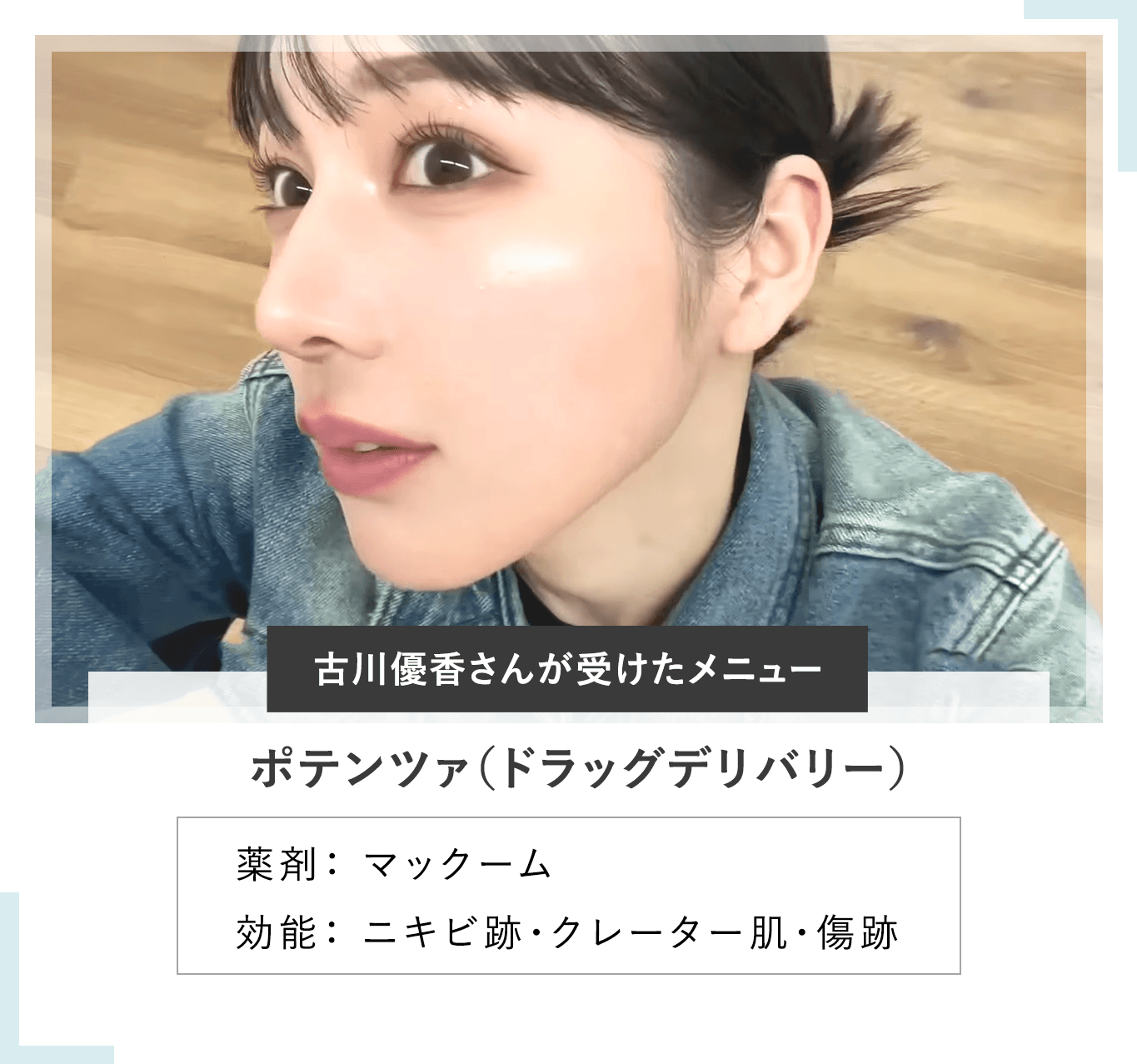 Aクリニックのフロアで笑顔でピースする古川優香さん