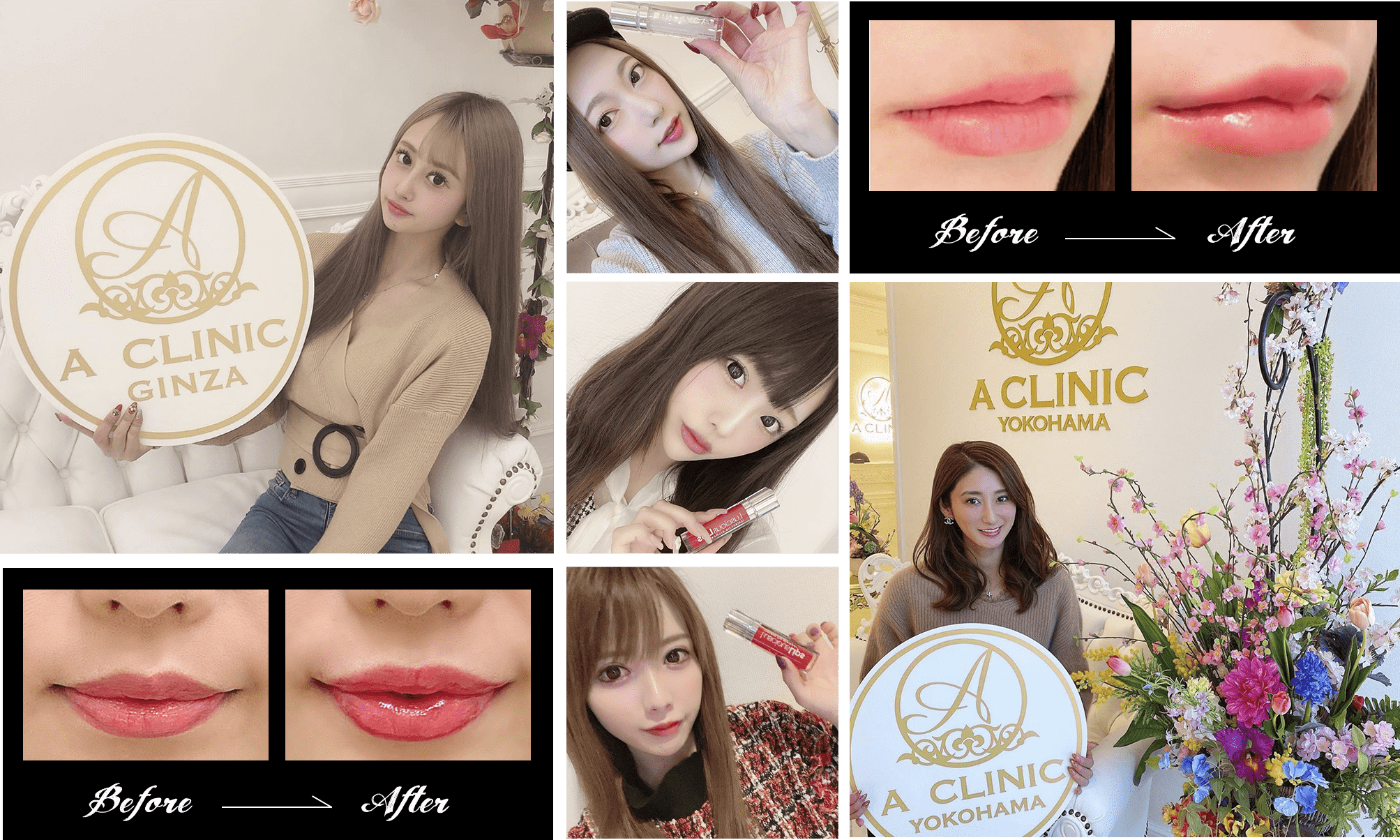 インスタグラムでスマイルリップが人気です