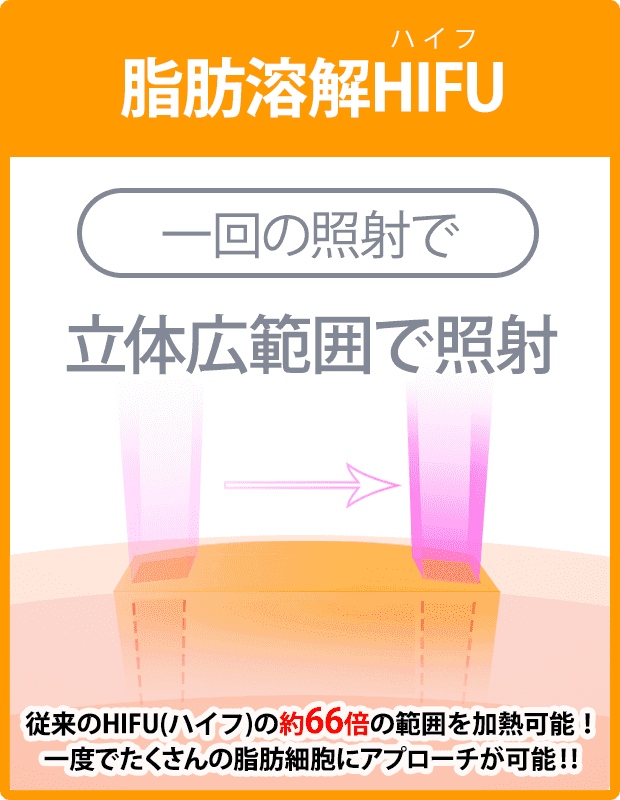 脂肪溶解HIFU 多列で面上の照射