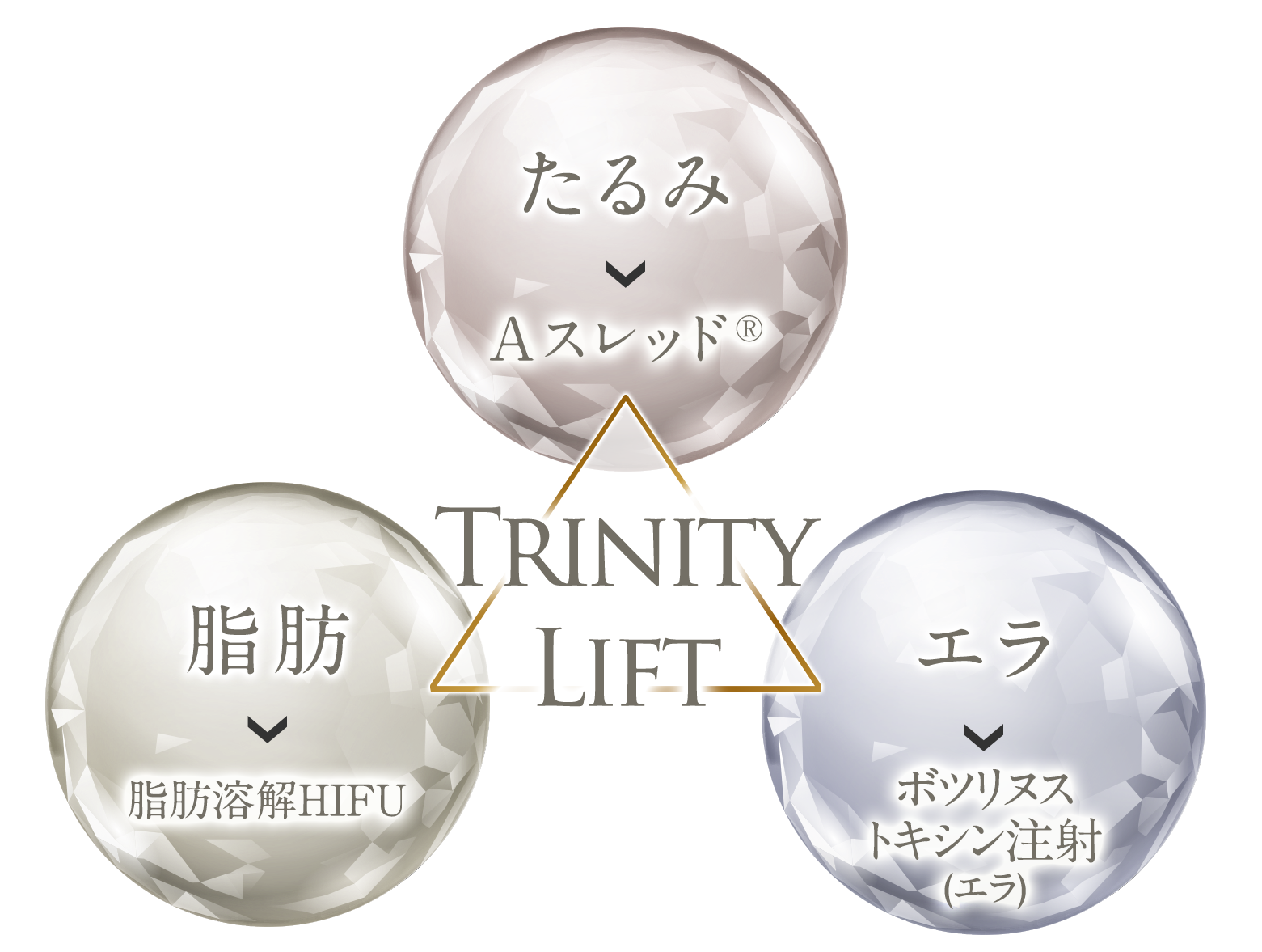 A式トリニティリフトとは