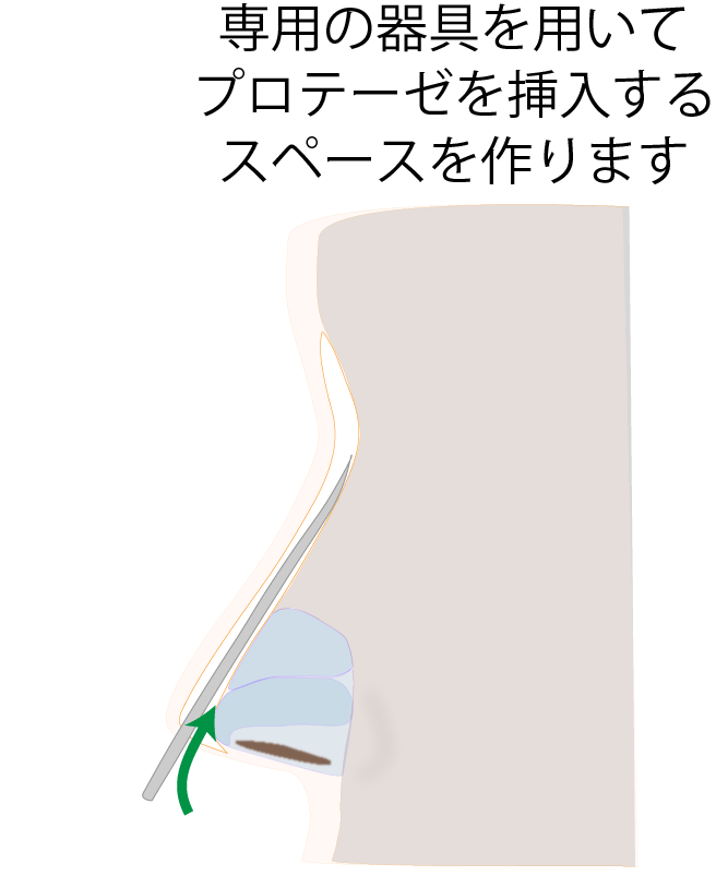②スペースを確保