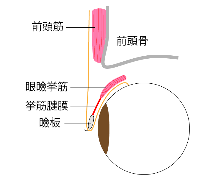 眼瞼下垂症 解剖図