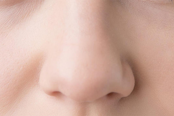 団子鼻を解消 鼻先縮小術埋没法 美容整形のa Clinic 美容外科 美容皮膚科 形成外科