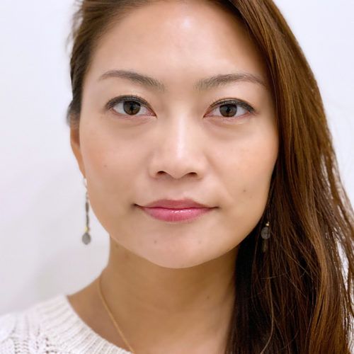 小顔になりたい方必見 Aスレッドなら15分で即小顔美人に 30代女性 美容整形のa Clinic 美容外科 美容皮膚科 形成外科