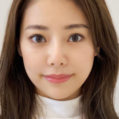 口横のもたつきはバッカルファット除去術で解決 スッキリしたフェイスラインに 30代女性 A Clinicは小顔 リフトアップ専門の美容整形クリニック