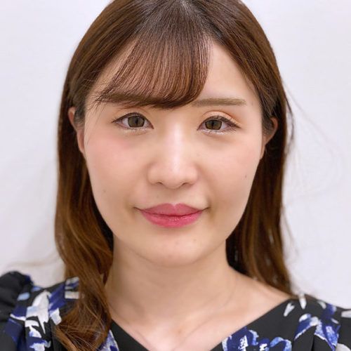 法令線 マリオネットラインが即日解消 Aスレッド 処置前と処置直後です 代女性 美容整形のa Clinic 美容外科 美容皮膚科 形成外科 法令線 マリオネットラインが即日解消 Aスレッド 処置前と処置直後です 代女性 美容整形のa Clinic 美容外科 美容皮膚科 形成外科