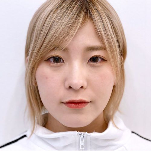 顔の余白が無くなる事で 引き立つ可愛さ Aスレッド 処置前と処置直後です 代女性 A Clinicは小顔 リフトアップ専門の美容整形クリニック