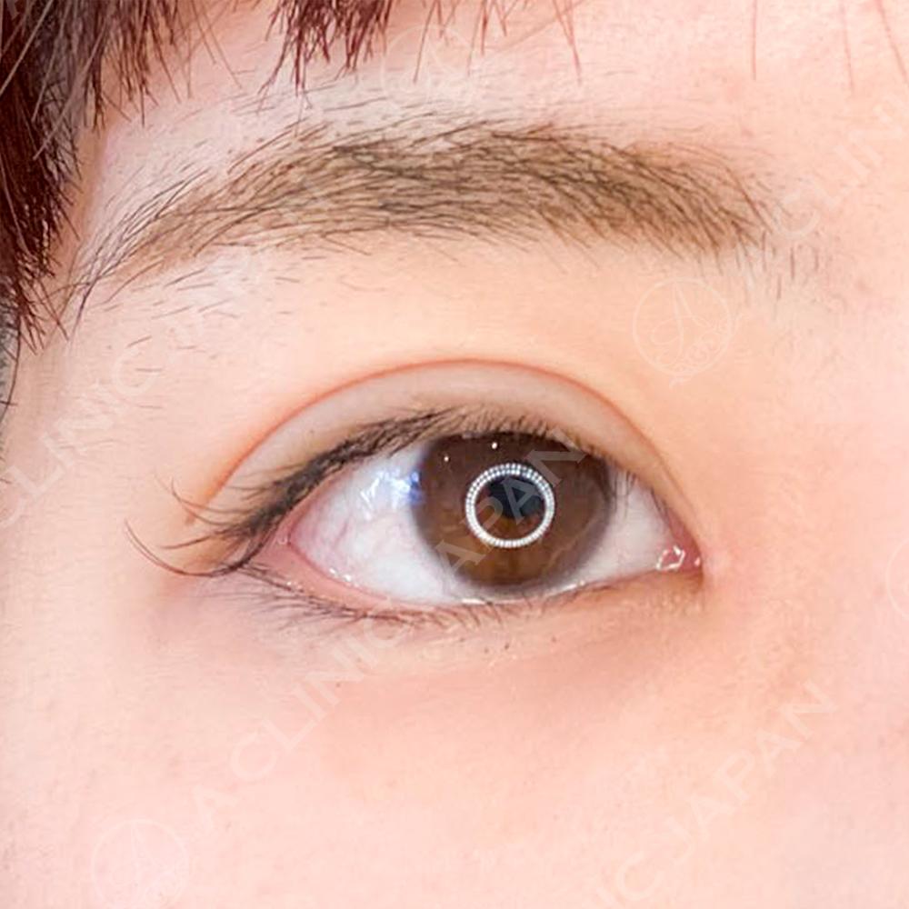 AFTER