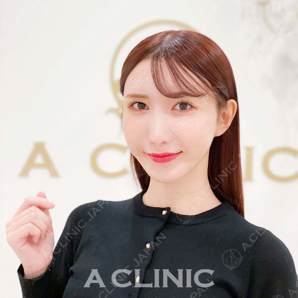 ナチュラルなのにしっかり小顔効果を実感！Aスレッドの処置前と処置直後の症例です(20代女性) AFTER