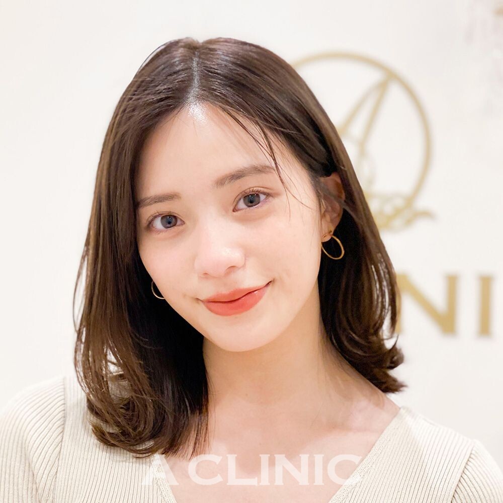 小顔になると美人度が倍増します！1day小顔脂肪吸引の処置前と1ヶ月後の症例です(20代女性) AFTER