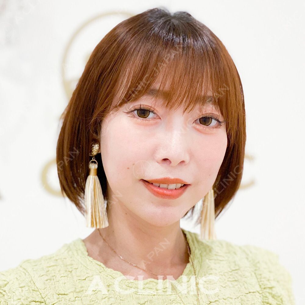 腫れがほぼない糸リフト！Aスレッドの処置前と処置直後の症例です(30代女性) BEFORE