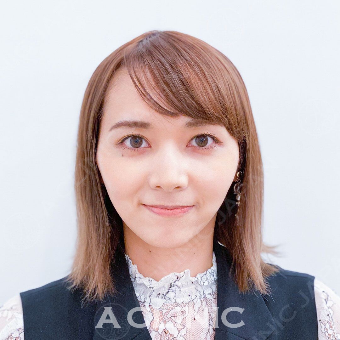 Aスレッドで当日から綺麗なVフェイスをゲット！処置前と処置直後の症例です(30代女性) AFTER