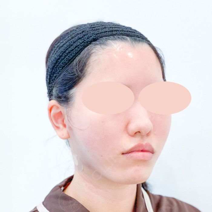 AFTER