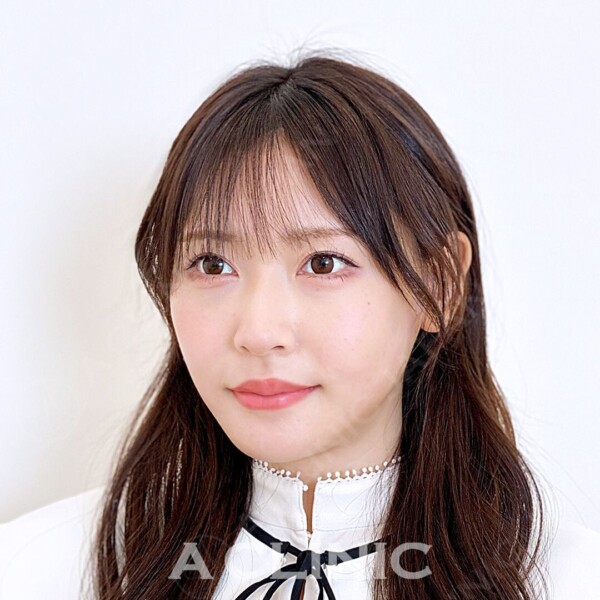 横からのフェイスラインもしっかり綺麗な輪郭に！処置前と処置直後の症例です(20代女性) AFTER