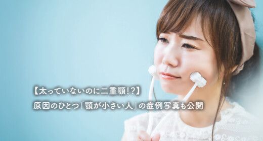 【太っていないのに二重顎！？】原因のひとつ「顎が小さい人」の症例写真も公開