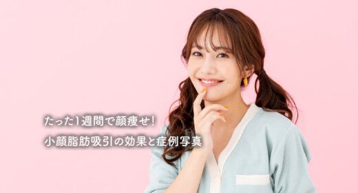 たった1週間で顔痩せ！小顔脂肪吸引の効果と症例写真